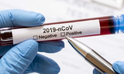 Pemprov Jatim Rapid Test 2020 Orang, 49 Dinyatakan Positif Corona