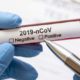 Pemprov Jatim Rapid Test 2020 Orang, 49 Dinyatakan Positif Corona